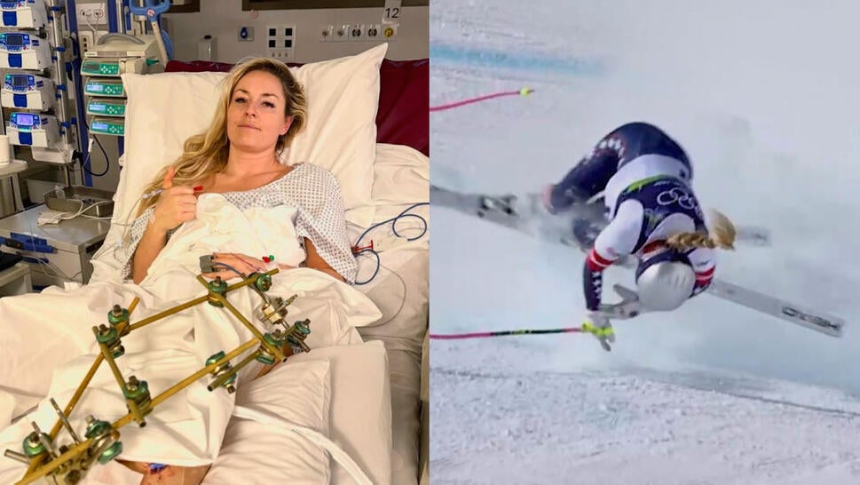 Lindsey Vonn in hospital, Vonn's skiing crash at the 2026 Winter Olympics