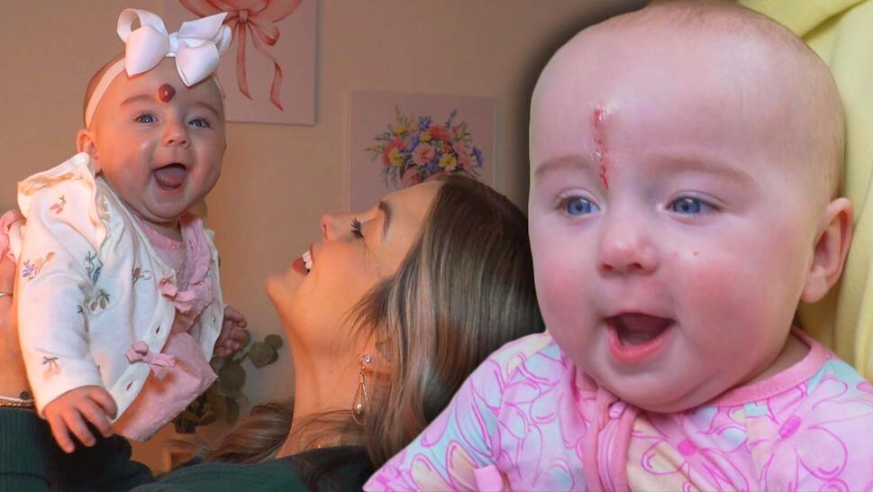 Baby Emory Risner smiling as mother, Bree Risner, lifts her into the air / Baby Emory Risner post-op with a wound above her right eyebrow 