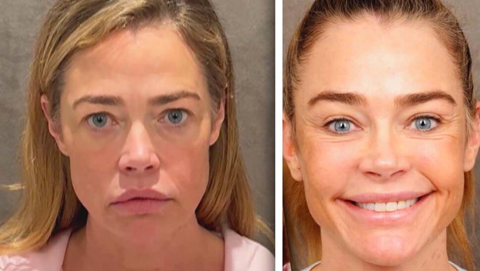 'Before' image of actress Denise Richards with neutral expression / 'After' image of actress Denise Richards smiling