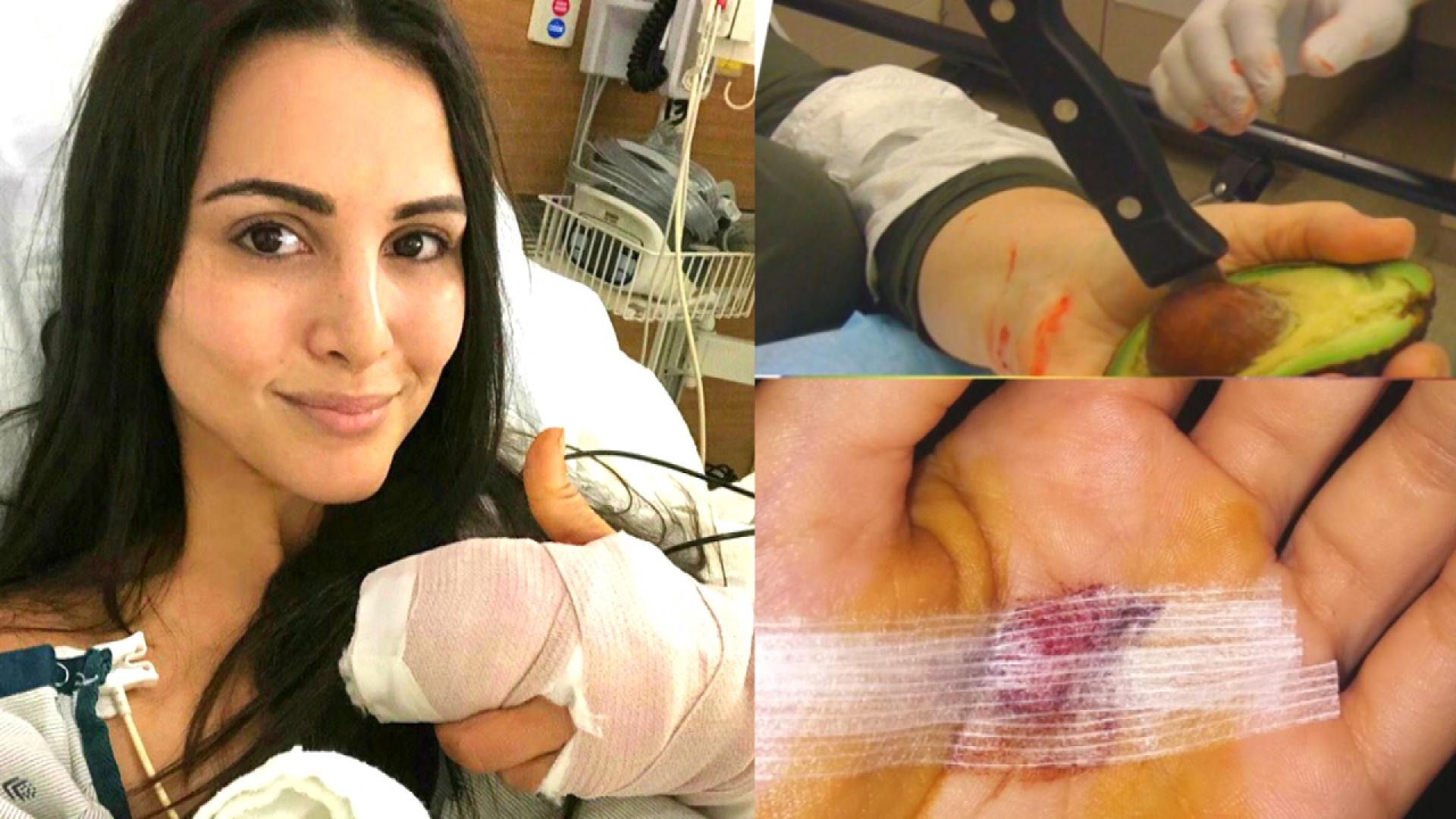 Bachelorette Andi Dorfman Has Surgery After Falling Victim To Avocado Hand Inside Edition