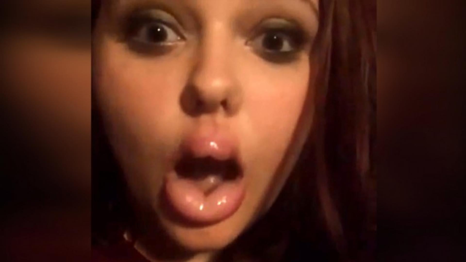 Kylie Jenner Lip Challenge Aftermath