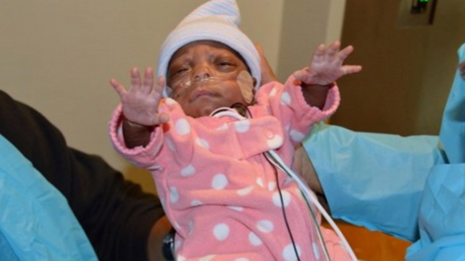 baby born 3 months early