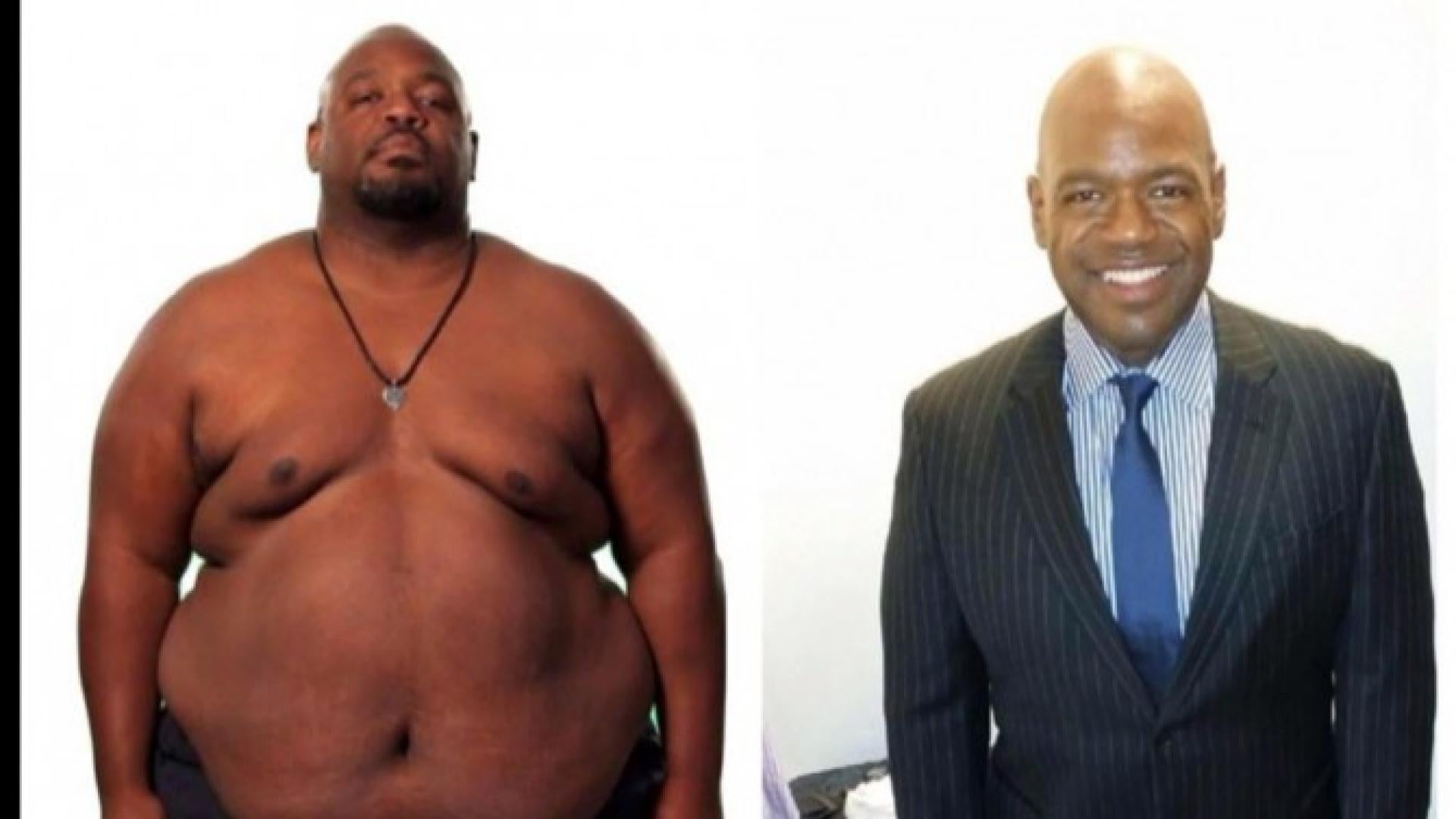 Teacher Who Dropped 180 Pounds On Extreme Weight Loss Dies