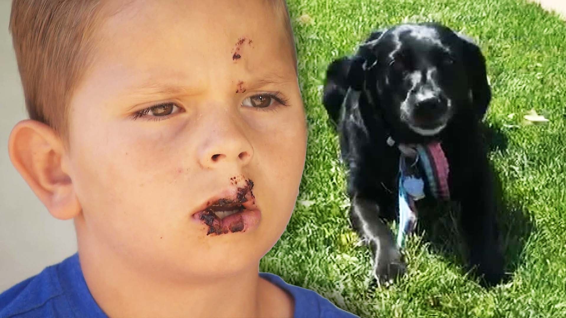 what happens when a dog bites a child in california
