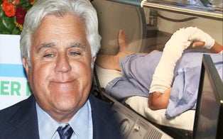 Jay Leno Undergoing Treatment in Hyperbaric Chamber for Severe Burns Sustained in Car Fire